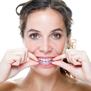 woman applying Invisalign liner